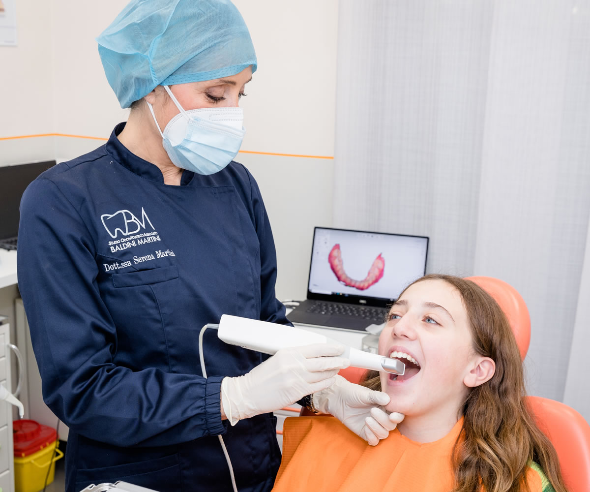 Sbiancamento dentale lampada arcoplasma